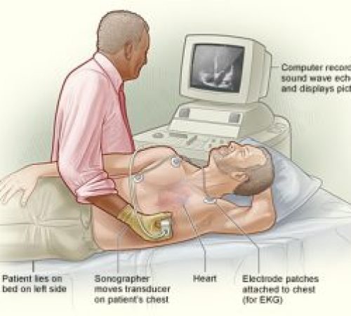 Echocardiogram-Illustration-300x224